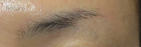 パーマネントメイクアップ施術前：1本1本の眉（拡大）