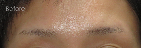 パーマネントメイクアップ施術前：1本1本の眉