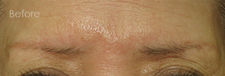 パーマネントメイクアップ施術前：若々優しいイメージのふんわり眉