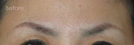 パーマネントメイクアップ施術前：他店で施術した後の修正