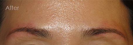 パーマネントメイクアップ施術後：若々しく魅せるストレート眉