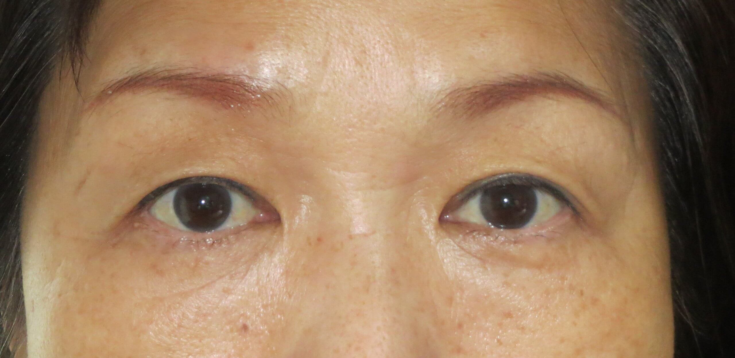 「加齢や薄眉のお悩み解消！自然な仕上がりの消えない眉（アートメイク）」