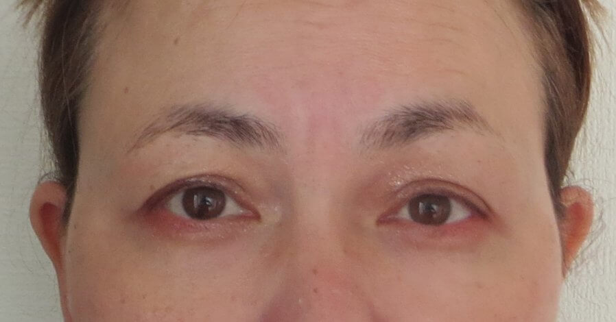 「メイクが苦手な方必見！理想の眉を手に入れる消えない眉施術」