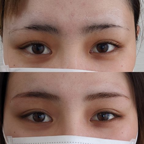 「沖縄那覇の消えない眉（パーマネントメイク）施術 – 朝のメイク時間を短縮」