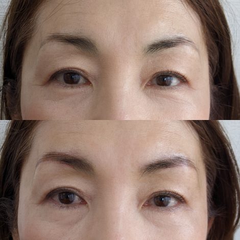 「汗や水に強いパーマネントメイクの効果」