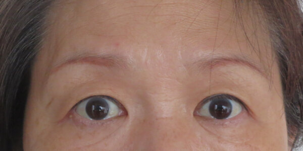 「加齢や薄眉のお悩み解消！自然な仕上がりの消えない眉（アートメイク）」